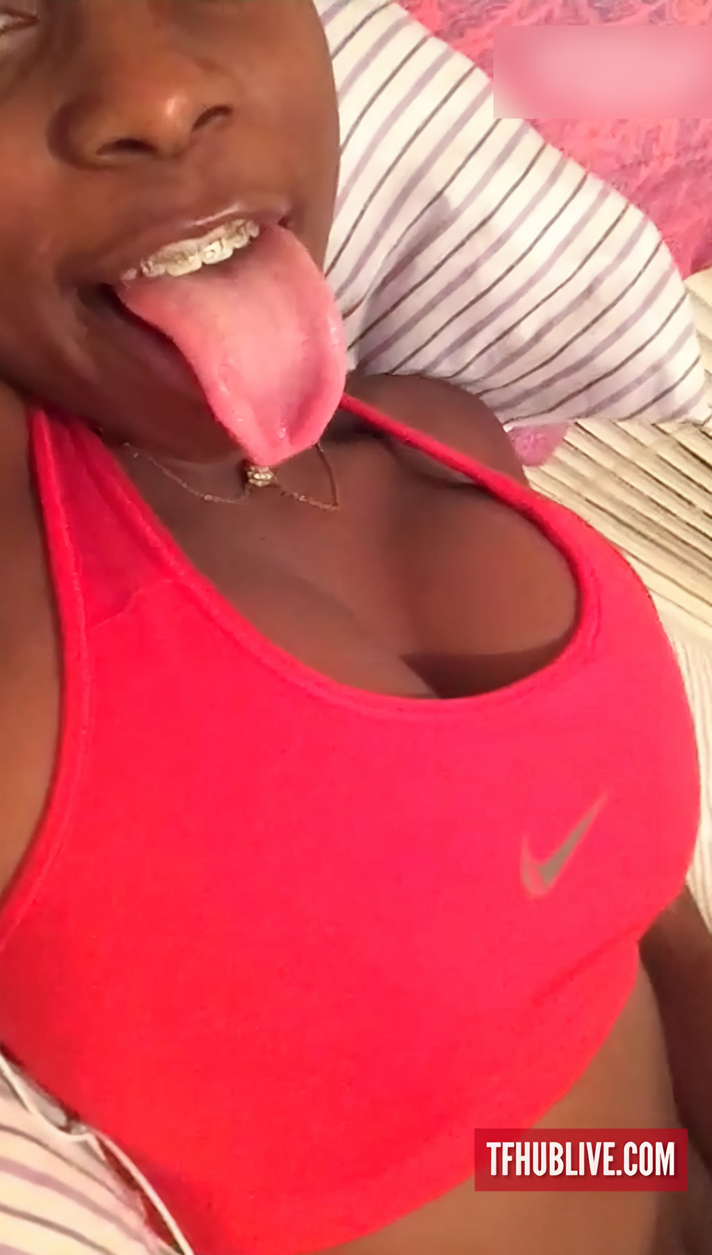 Girl with braces sucking fingers