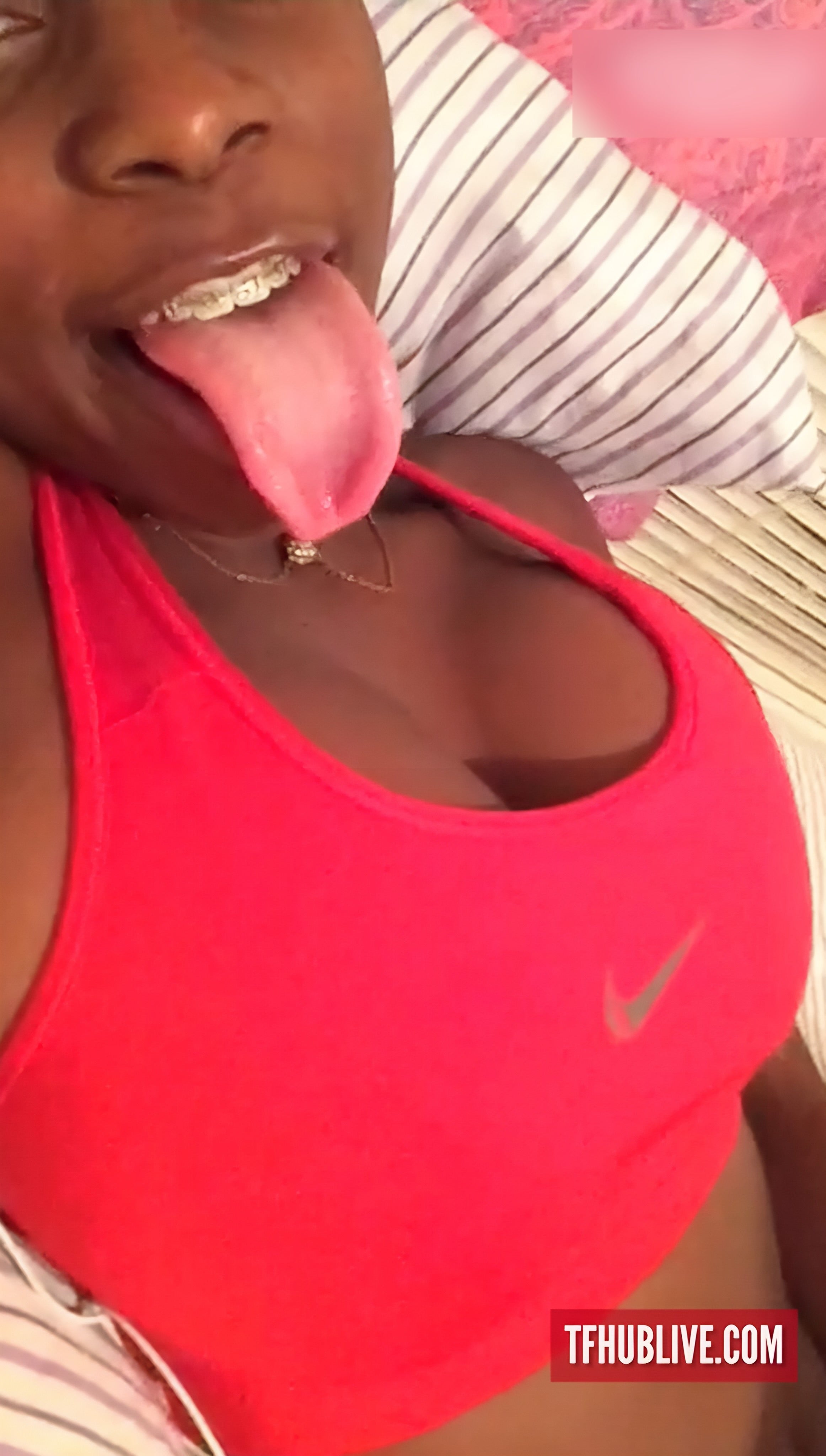 Girl with braces sucking fingers